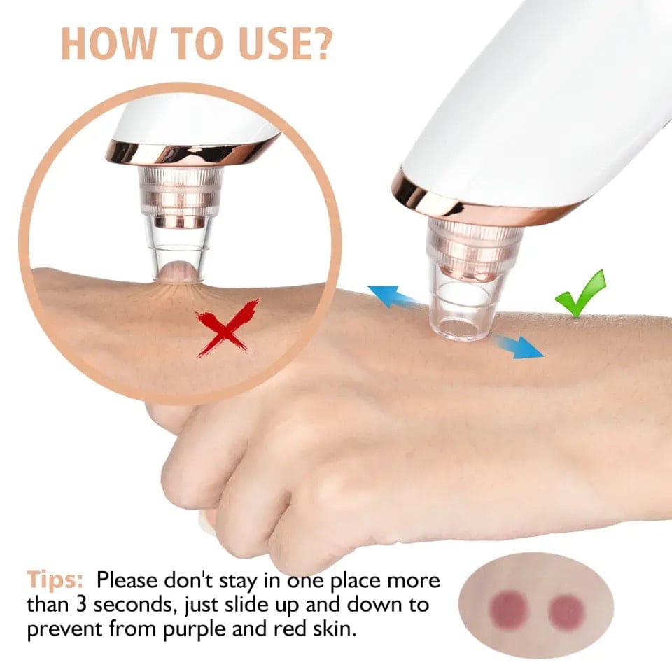 Pore purifier blackhead remover