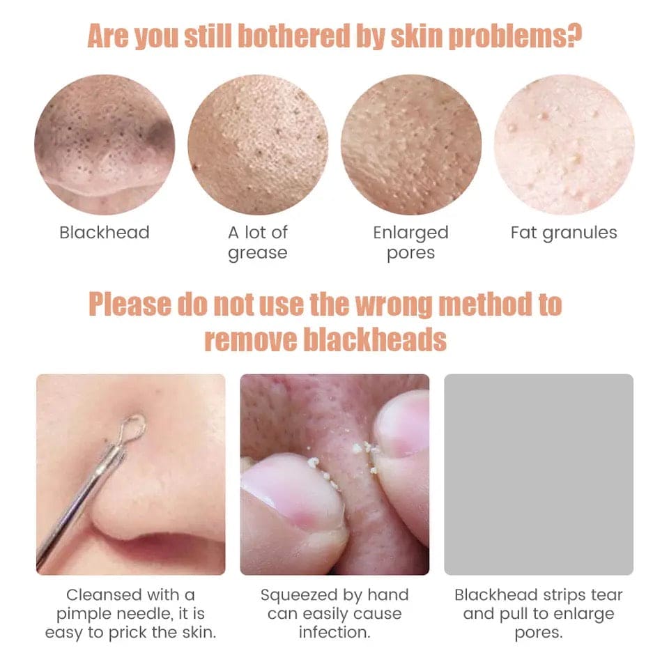 Pore purifier blackhead remover